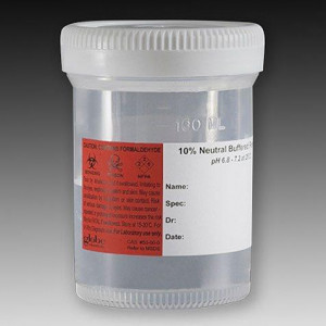 Pre-Filled Container: Tite-Rite, 120mL (4oz), PP, Filled with 60mL of 10% Neutral Buffered Formalin, Attached Hazard Label, 100/Unit